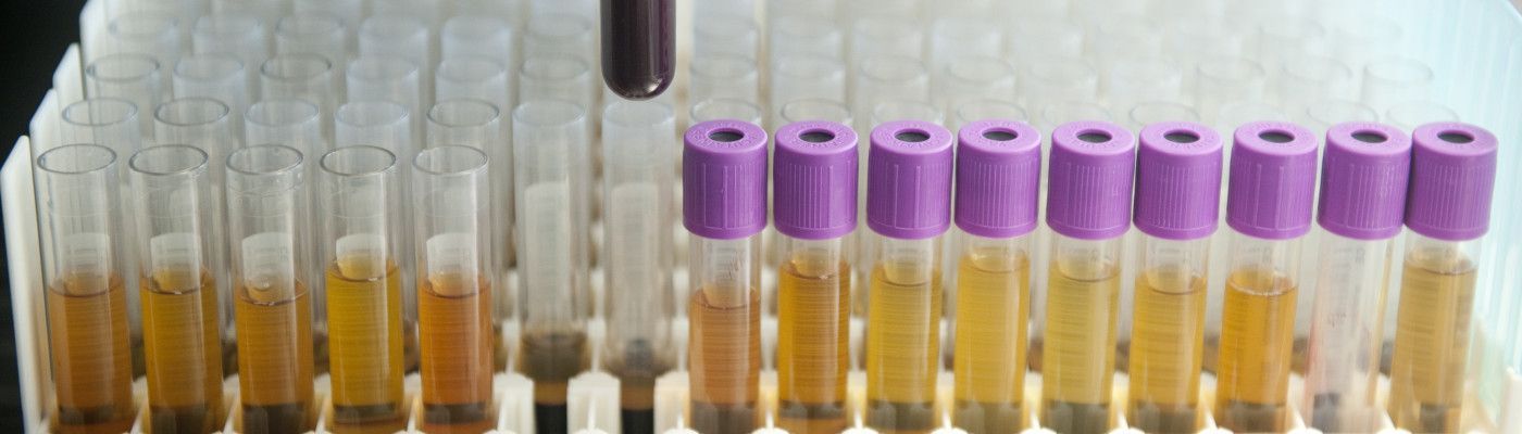 urine samples laboratorium