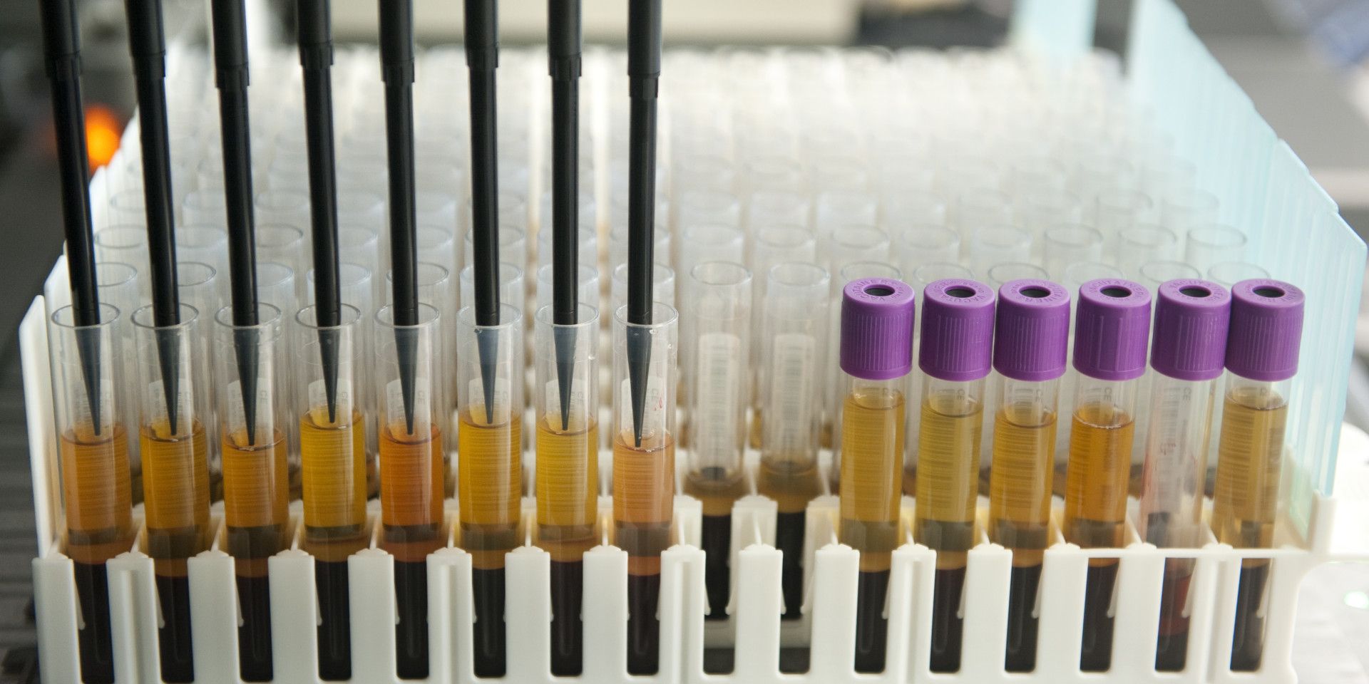 urine samples laboratorium